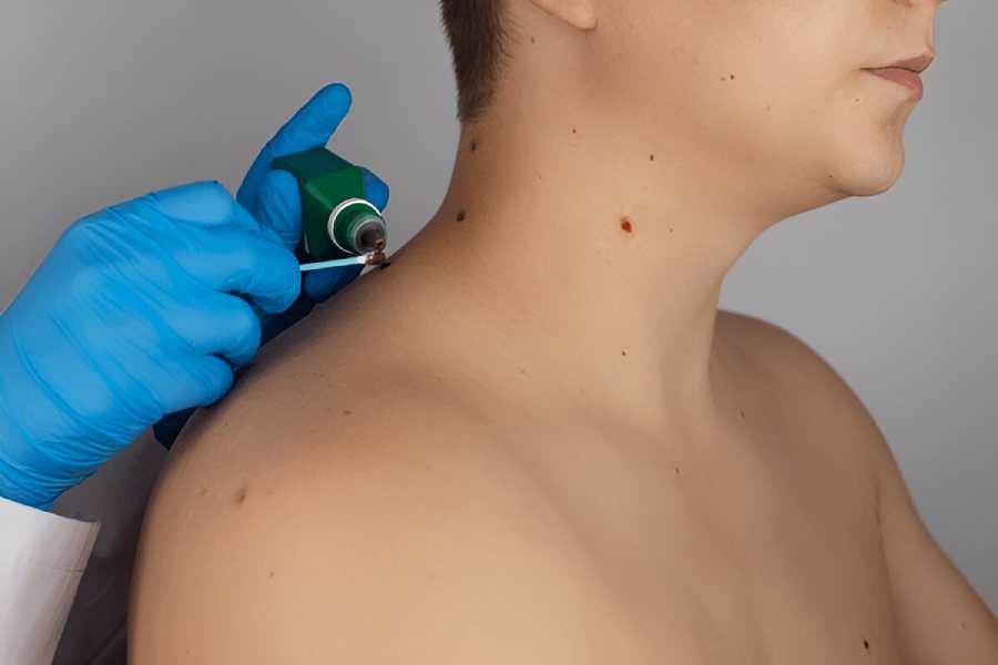skin-treatment