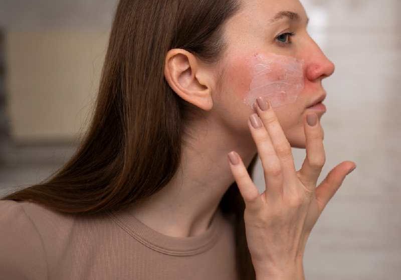 Sensitive Skin